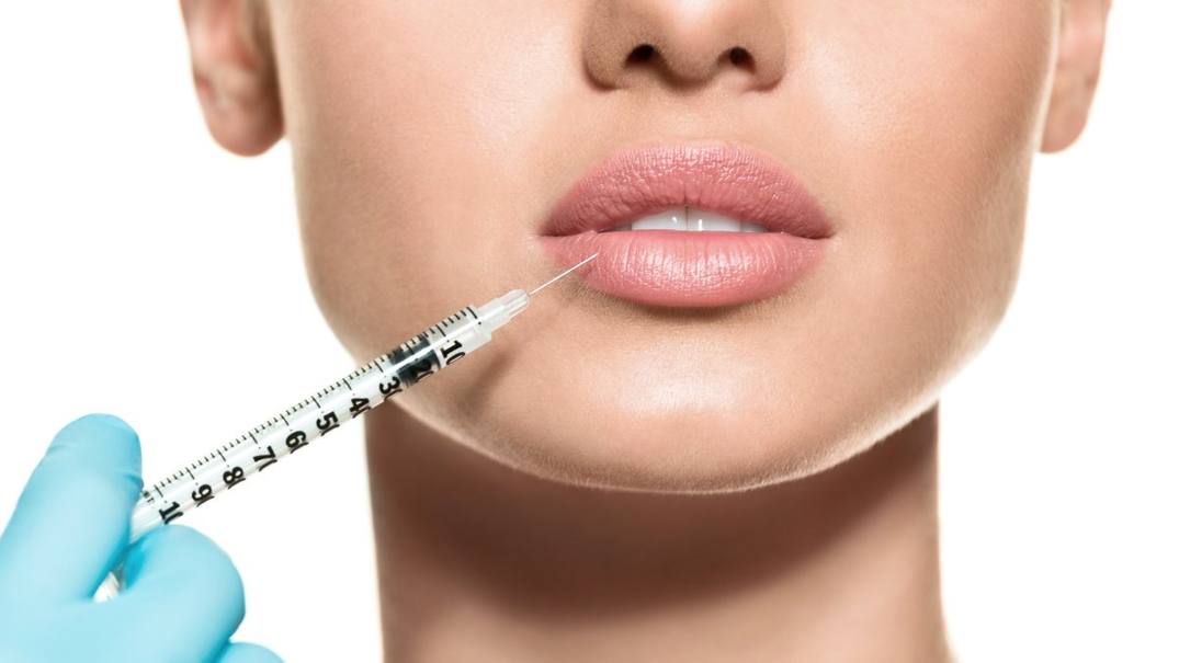 Dermal lip fillers in Bromley